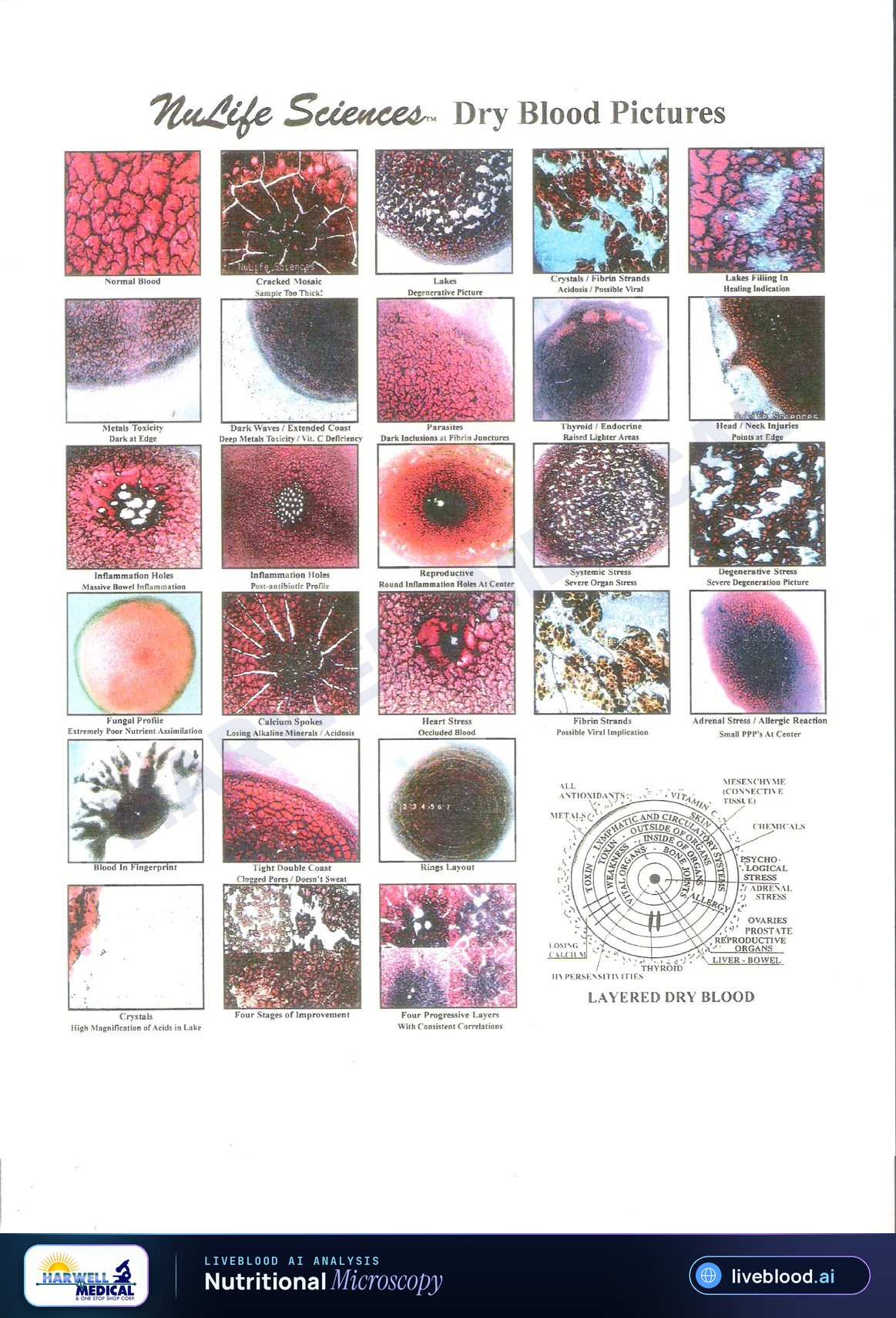 NuLife Sciences dry blood pictures reference gallery showing examples of dried blood image patterns used in microscopy education